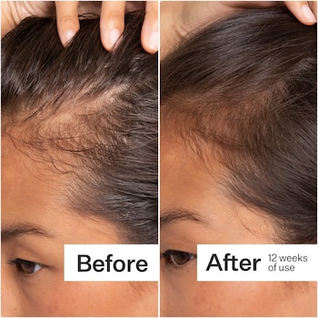 Act+Acre 2% Stem Cell H-2 Grow Complex ™ Scalp Serum For Thicker-Looking Hair *Pre-Order*