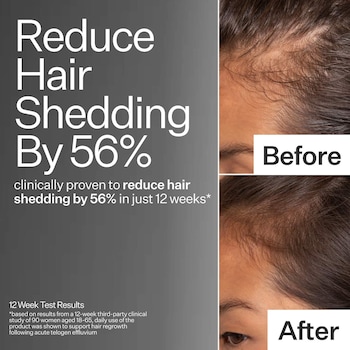 Act+Acre 2% Stem Cell H-2 Grow Complex ™ Scalp Serum For Thicker-Looking Hair *Pre-Order*