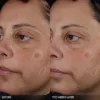 Topicals Faded Tranexamic Acid Dark Spot Patches for Hyperpigmentation *Pre-Order*